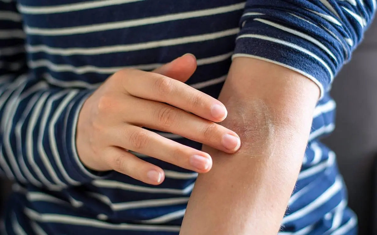 راهکارهای طلایی برای مقابله با خشکی پوست و حفظ طراوت طبیعی